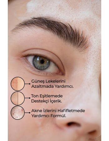 SABUN KOJIC ACID 125 G